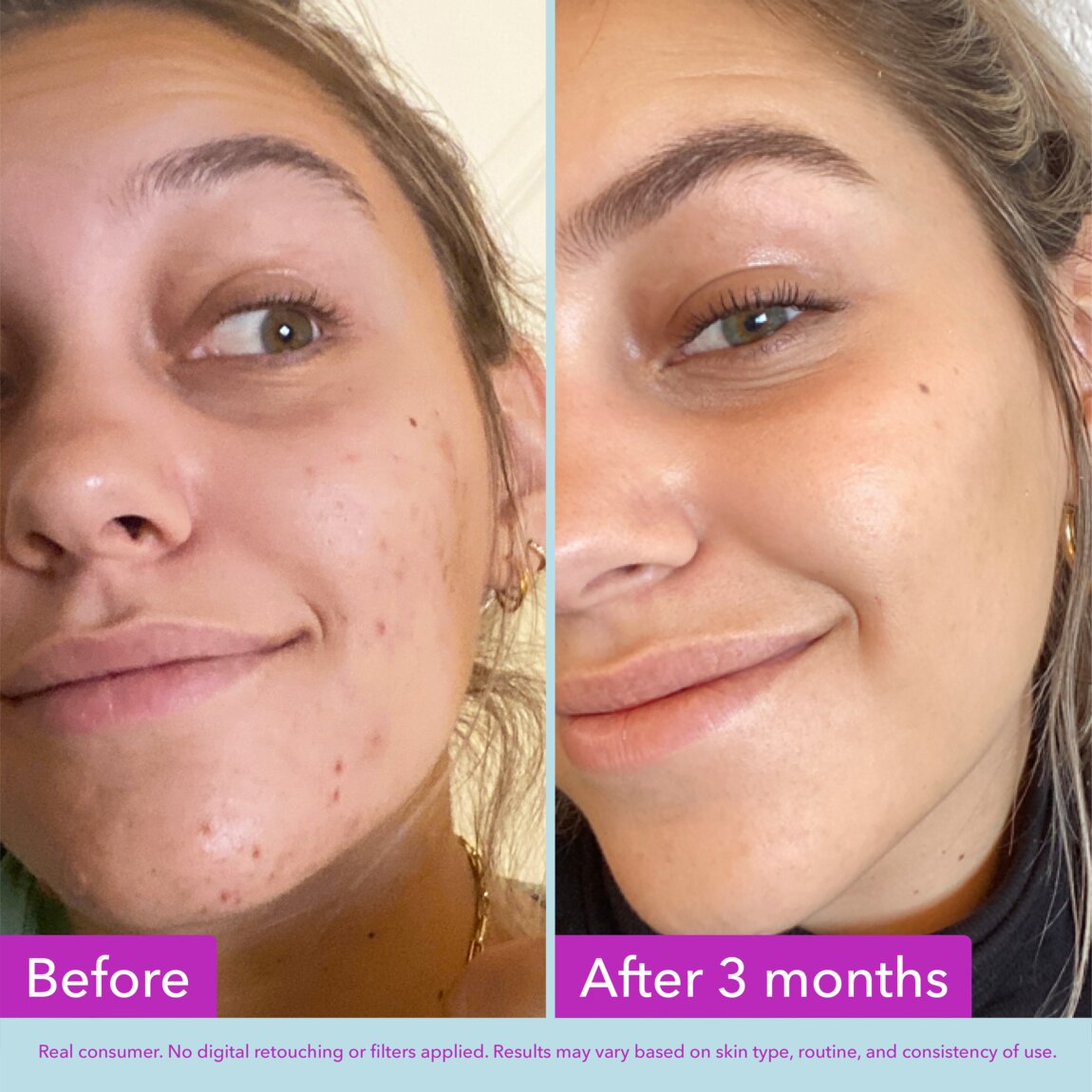 niacinamide-brightening-toner-v9 zb_p.jpg