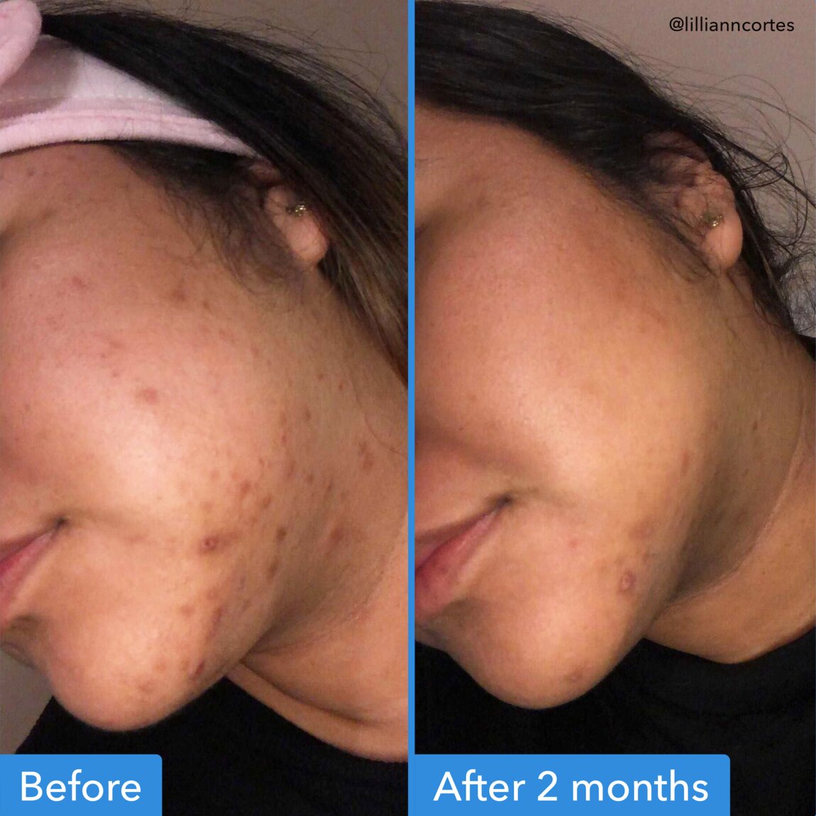 discoloration-correcting-serum-d3 zb_p.jpg